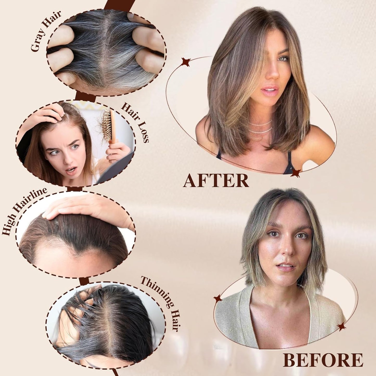 Rachel - 100% Human Hair 14 Inch Hair Toppers for Women Hair Pieces