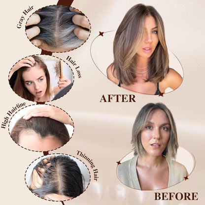 Rachel - 100% Human Hair 14 Inch Hair Toppers for Women Hair Pieces